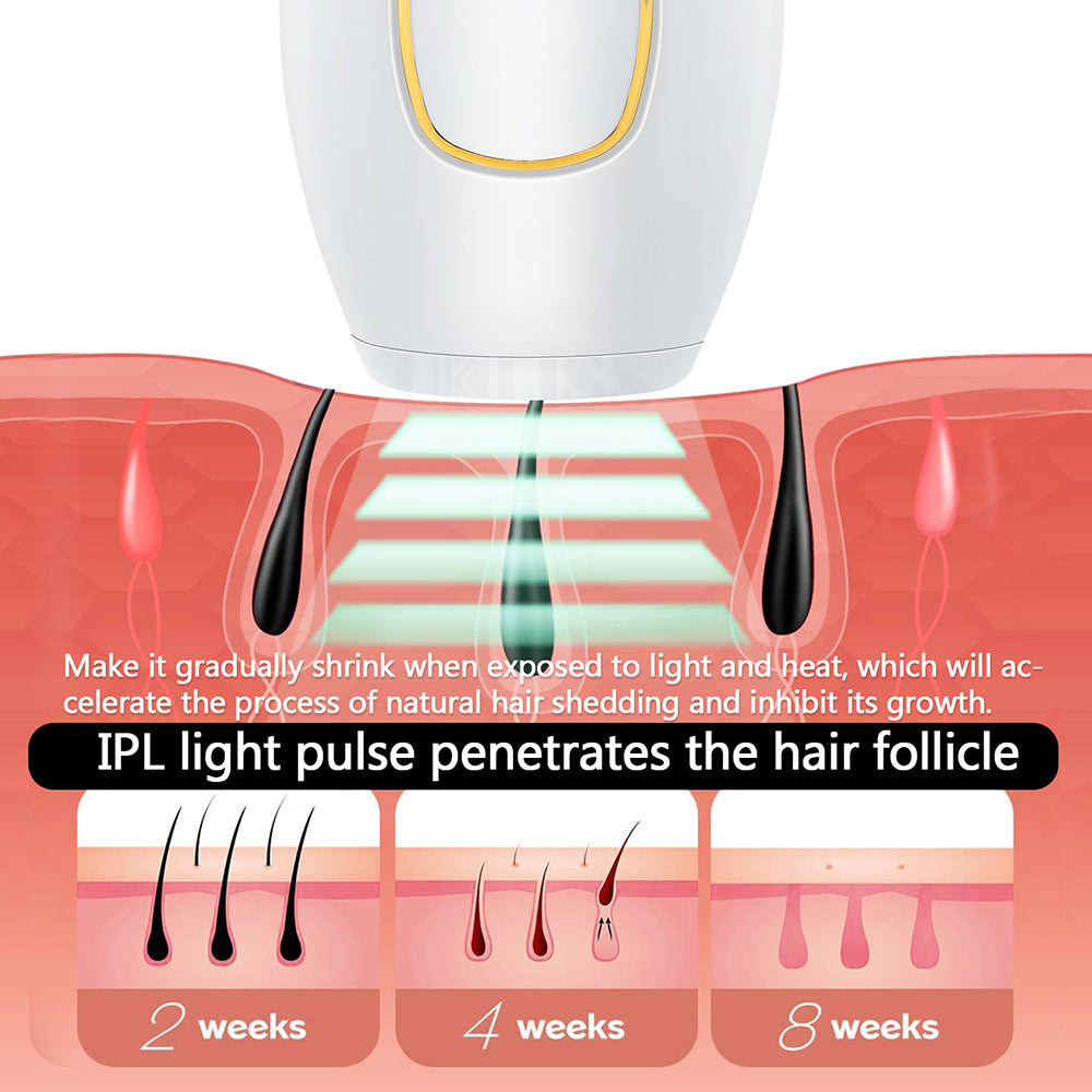 Silky Infinity™ | IPL-ontharingsapparaat | Het geheim van een gladde, haarvrije huid